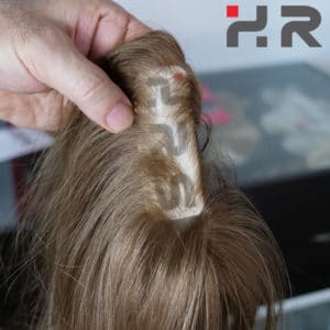 protesi capelli iniettati
